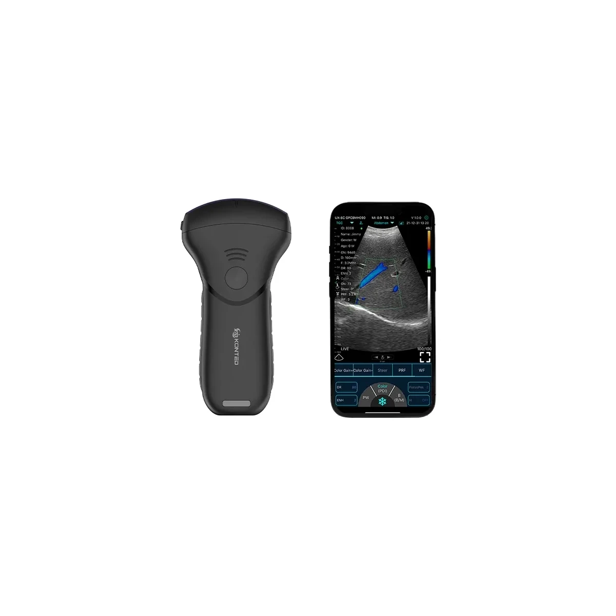 Wireless Handheld Ultrasound