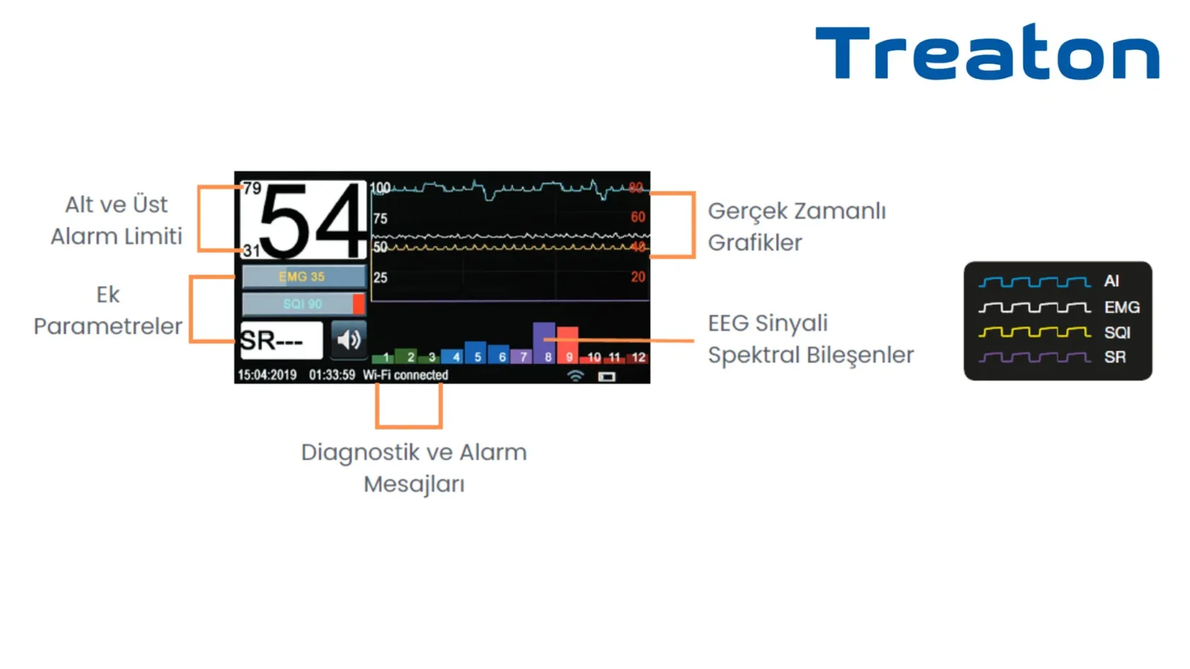 MGA-06 ANESTEZİYA DƏRİNLİK MONİTORU (BIS MONİTORU) 4