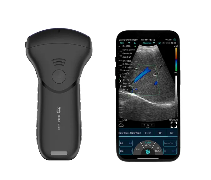 KONTED CONVEKS HAND HELD WIRELESS ULTRASOUND