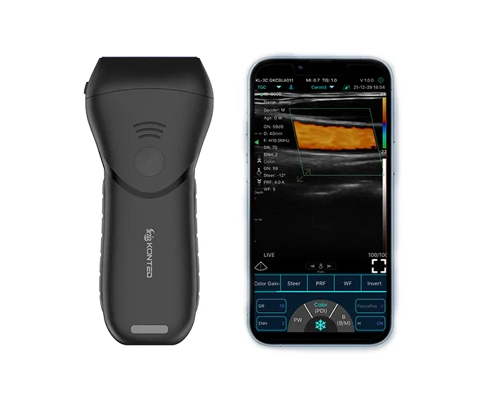 CONTED LINEAR HAND HELD WIRELESS ULTRASOUND