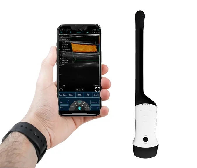 CONTED CONVEX + TRANSVAGINAL HAND-HOLD WIRELESS ULTRASOUND