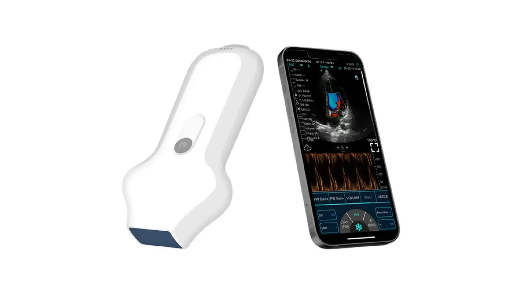 CONTED CARDIAC HAND-HELD WIRELESS ULTRASOUND